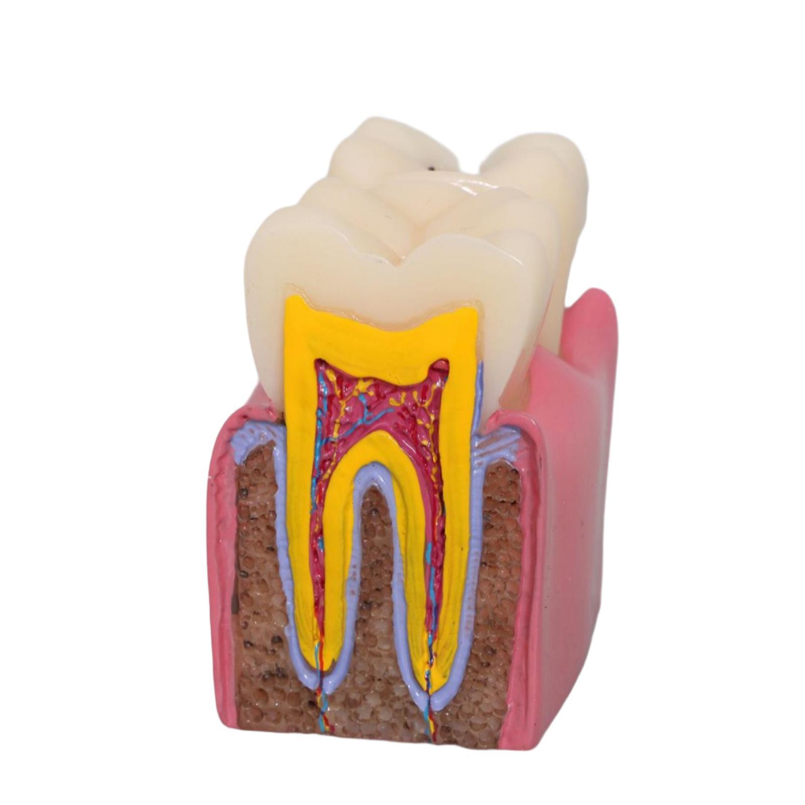Tooth Decay Model Roots Canal  - đánh giá và giá Kids Education Classes